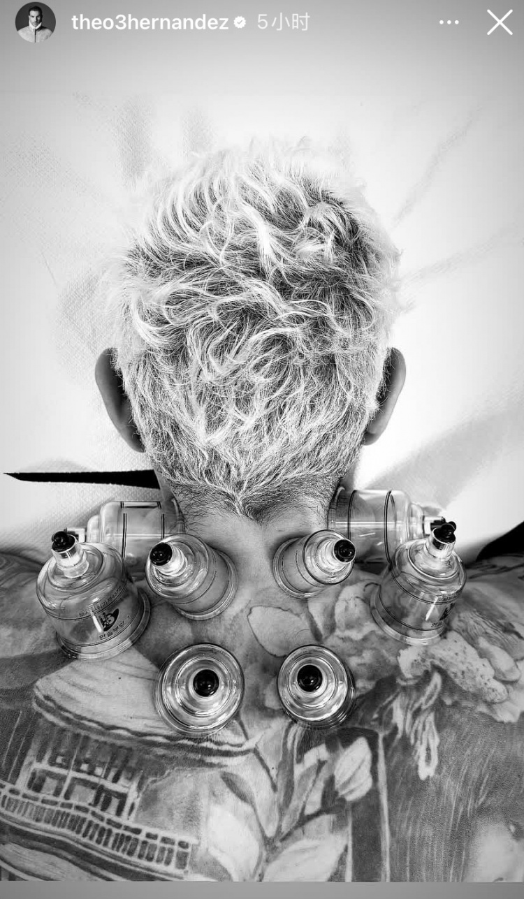 神秘東方力量加持？特奧社媒曬照，自己正在接受拔罐治療